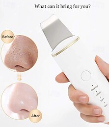 olcso -ultrahangos bőrradír vibráció arc spatula mitesszer eltávolító arcradír lapát tiszta kavitáció peeling arc lifting