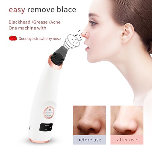 

Blackhead Vacuum Acne Remover Facial Pore Cleaner Electric Acne Pimple 3 Adjustable Suction Powers USB Rechargeable LED Screen Blackhead Extractor Tool Suitable for Women and Men