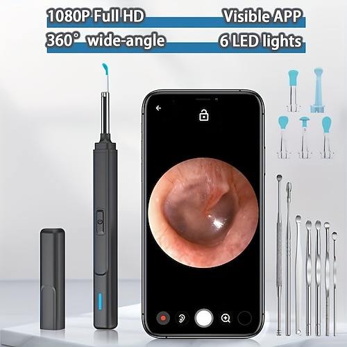 

smart visual pulitore dell'orecchio bastone dell'orecchio endoscopio earpick camera otoscopio pulitore dell'orecchio rimozione del cerume orecchio picker strumento di rimozione del cerume