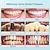 Χαμηλού Κόστους Προσωπική Προστασία-ηλεκτρικός υπερηχητικός καταιονιστής οδοντιατρική απολέπιση πέτρας στοματική αφαίρεση πέτρας καθαριστής λεκέδων δοντιών led εργαλεία καθαρισμού λεύκανσης δοντιών