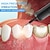 abordables Protección personal-Escalador dental, eliminador de placa de sarro, kit de vibración para blanquear los dientes, limpiador de piedra blanqueadora, higiene bucal, herramientas de cuidado limpio