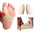 baratos Ligas e Suportes-1 par de mangas de joanete: evita lesões, melhora a saúde dos pés &amp; dedos corretos!