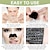 Χαμηλού Κόστους Home Health Care-10 τμχ/σετ μάσκα αφαίρεσης μαύρων στιγμάτων μύτης καθαριστής πόρων μάσκα θεραπείας ακμής βαθύς καθαρισμός πόρων μύτης φροντίδα δέρματος