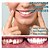 お買い得  入浴とパーソナルケア-調整可能なスナップオン義歯 1 組、歯プロテクター マウスガード 2 個、透明な歯のブレース、自然な色合いのフェイクベニア、日常生活用の義歯装飾