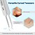 cheap Personal Care &amp; Health-Blackhead Remover and Pimple Popper Tool Kit, Acne Extractor Set with Ingrown Hair Tweezers, Ultra-Fine Precision Tweezers, Blackhead Pore Cleaner Tools for Face, Stainless Steel