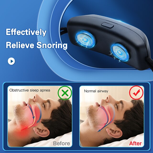 Smart Anti Snoring Device EMS Pulse Stop Snore Portable Comfortable