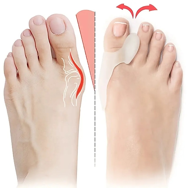  protección del cojín del juanete (adecuado para uso nocturno y doméstico y reemplácelo regularmente) corrector del dedo del pie que alivia la presión para aliviar el dolor