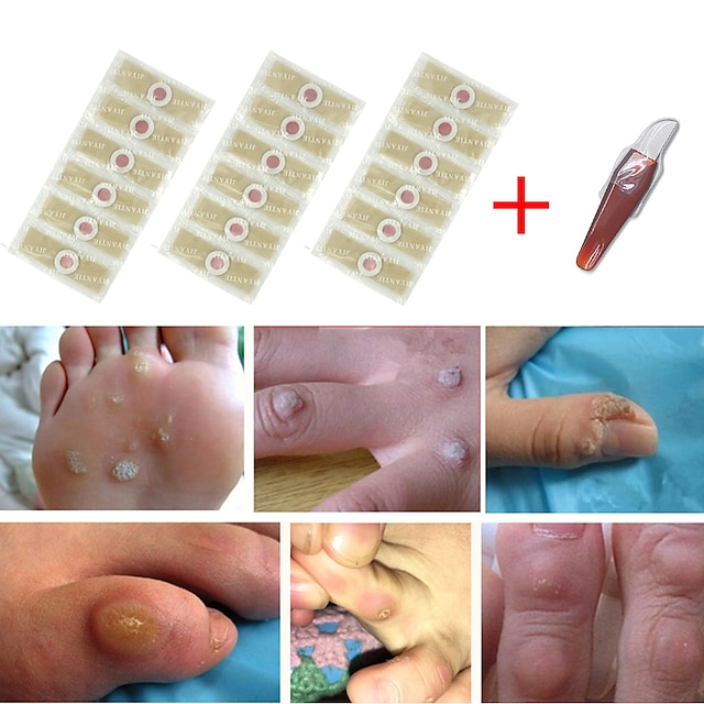  Adesivos médicos para cuidados com os pés, 24 unidades, para remoção de milho, verrugas, espinhos, calosidades, desintoxicação e cura dos pés