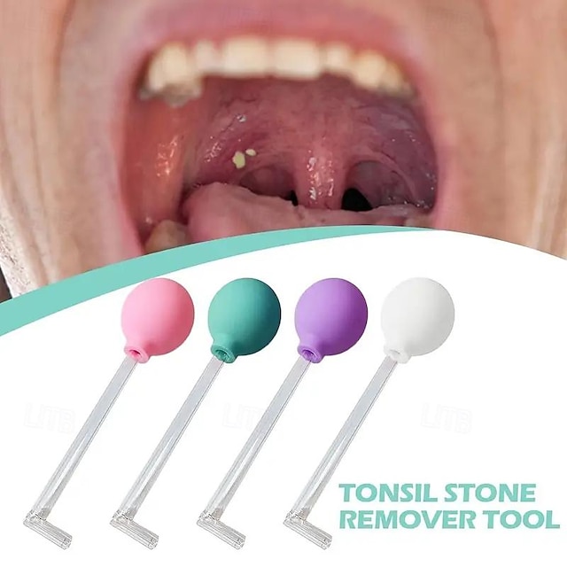  1 herramienta de eliminación de cálculos de amígdalas fácil de usar con succión suave, potenciador de salud bucal, kit de higiene dental para uso doméstico
