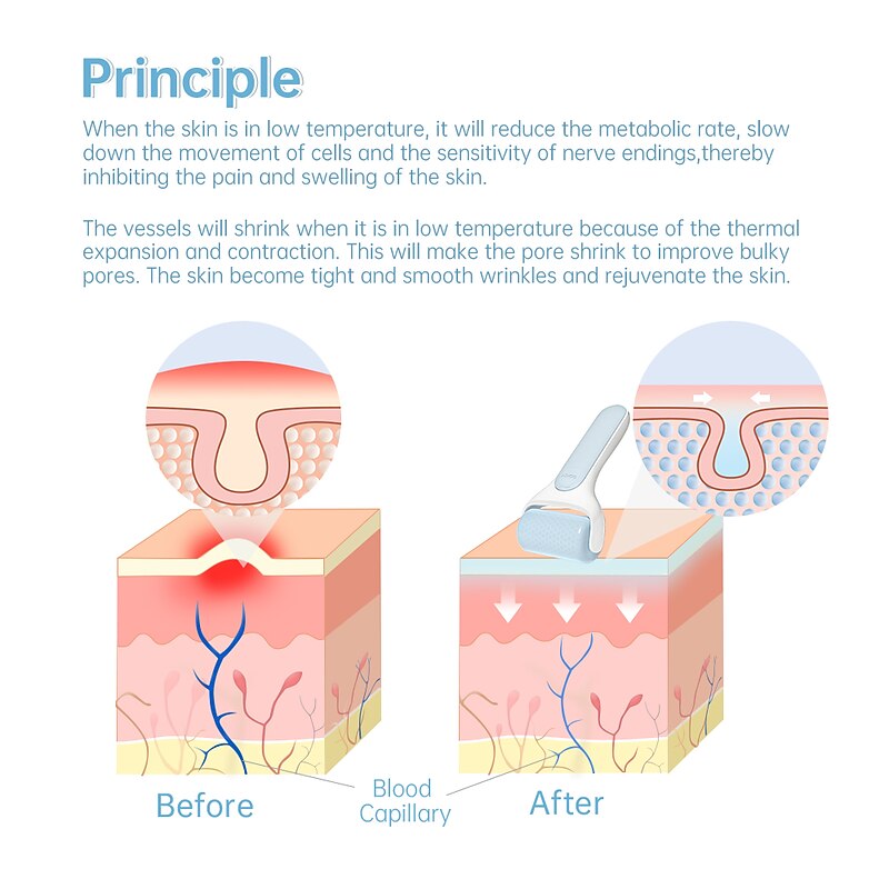 Original Skincare Ice Roller For Face SOICY S20 Derma Cooler Massager For Face Lift Sun Damage Redness Pain Relife2