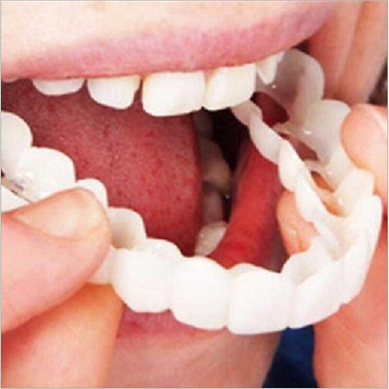 Simulation Braces Silicone Simulation Braces Teeth Smile,Bite-Tooth veneers-Upper and Lower Teeth are Used for whitening Teaching to Cover Imperfect Teeth and Make You Smile Instantly and Confidently