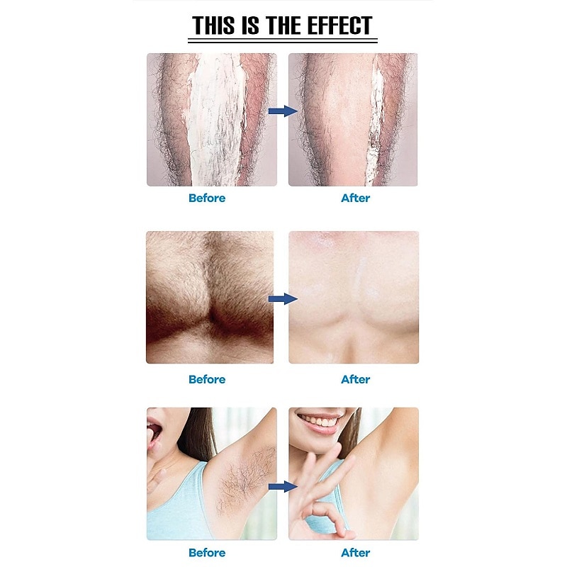 Crystal Hair Eraser for Women and Men Magic Hair Remover Painless Exfoliation Magic Hair Removal Tool Crystal Hair Remover for Arms Legs Back3