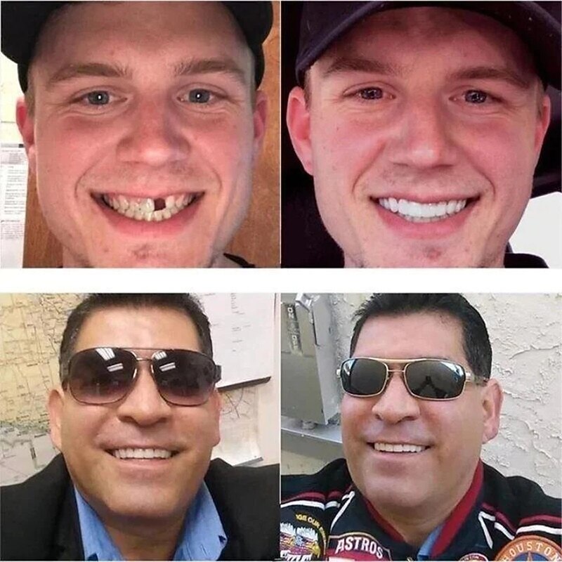 Simulation Braces Silicone Simulation Braces Teeth Smile,Bite-Tooth veneers-Upper and Lower Teeth are Used for whitening Teaching to Cover Imperfect Teeth and Make You Smile Instantly and Confidently3