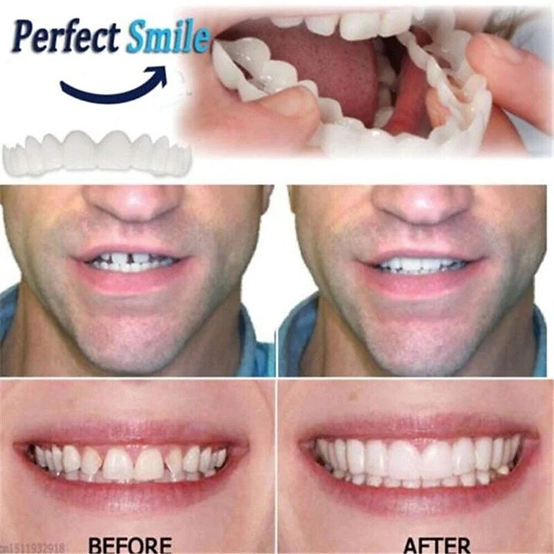 Simulation Braces Silicone Simulation Braces Teeth Smile,Bite-Tooth veneers-Upper and Lower Teeth are Used for whitening Teaching to Cover Imperfect Teeth and Make You Smile Instantly and Confidently4