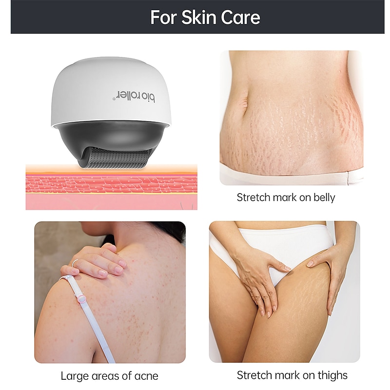 1200Pin Derma Roller  For Face Body Acne Stretchmark Removal Microneedle Roller For Beard Hair Growth4