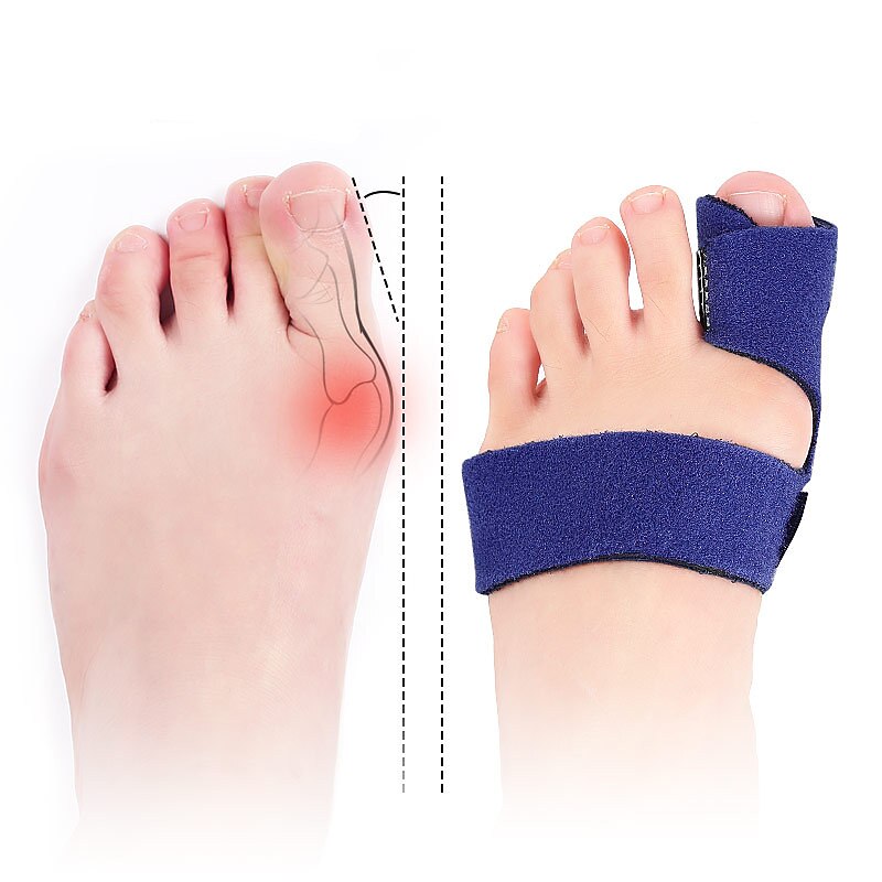 1PC Trigger Finger Extension Splint Finger Brace Adjustable Fixing Belt Hand Support for Straightening Curved Finger Fractures Care Locked Stenosing Tenosynovitis Tendon Release Pain Relief2