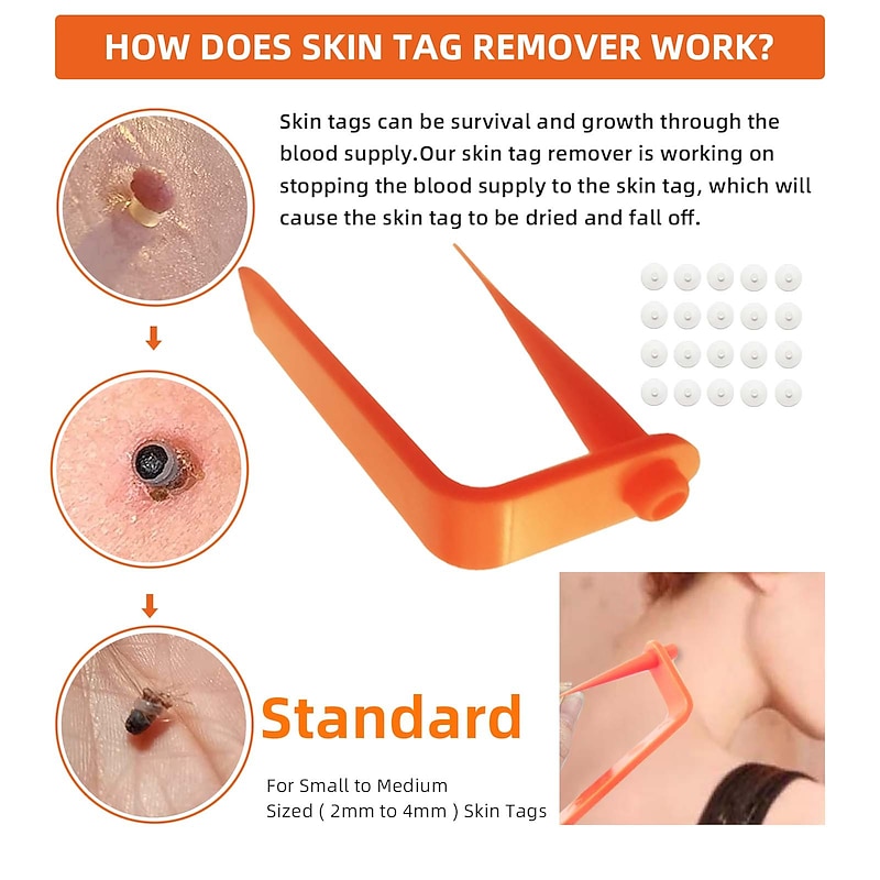 Painless Safe Skin Tag Remove Device Kit Micro Tags Size (2mm to 4mm) Warts Remover Original Skin Band Tool Set3