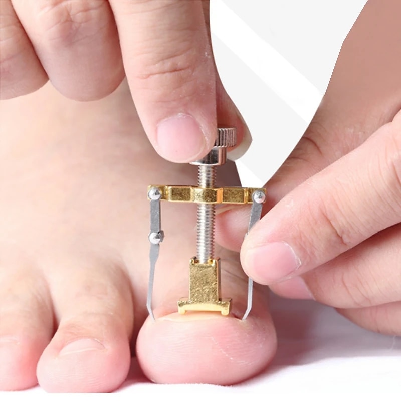 2Pcs Ingrown Toenails Corrector Stainless Steel Nail Straightening Tool Relief Pain Pedicure Tool For Ingrown Toenail Recover2