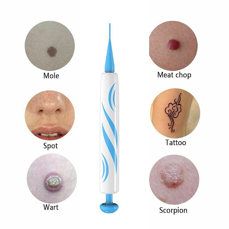 2 IN 1 Auto Micro Skin Tag Remover Device Standard And Micro Skin Tag Removal Kit Adult Mole Wart Remover Original Face Care Beauty Tool3