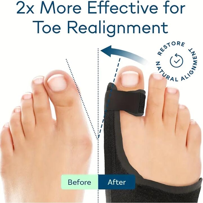 Toe Separator For Bunion Relief, (Fit Up To 100kg) Bunion Corrector For Women And Men Big Toe Pain Relief Set, Day & Night 24hrs Support Big Toe Straightener, Big Toe Hammer Bunion2