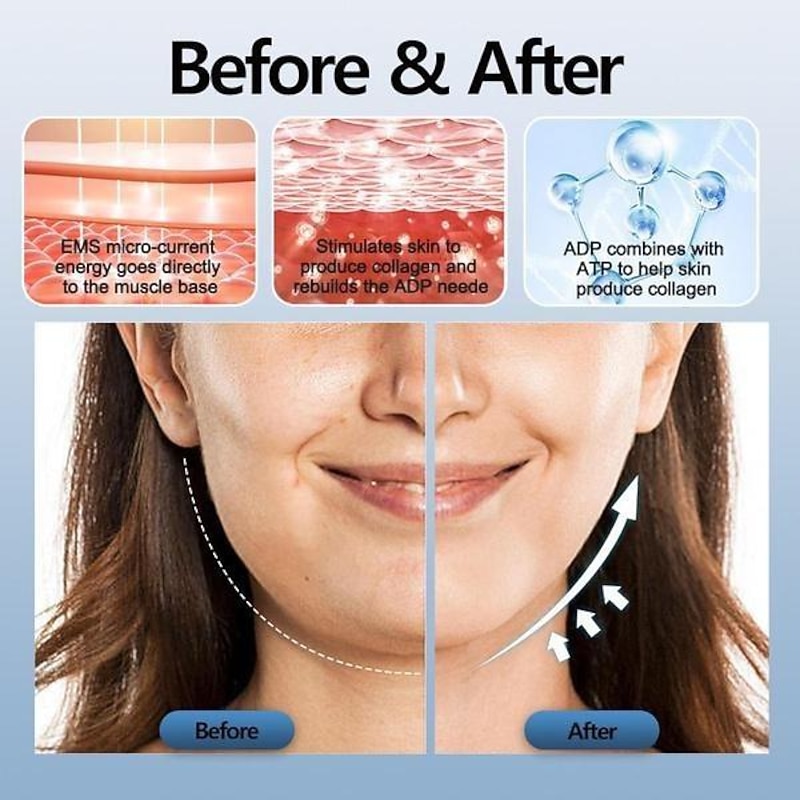 Portable Ems Facial Massager V-Face Beauty Device Electric Shaping Massager To Removing Double, Smart Anti Snoring Reduction Muscle Stimulator Device4