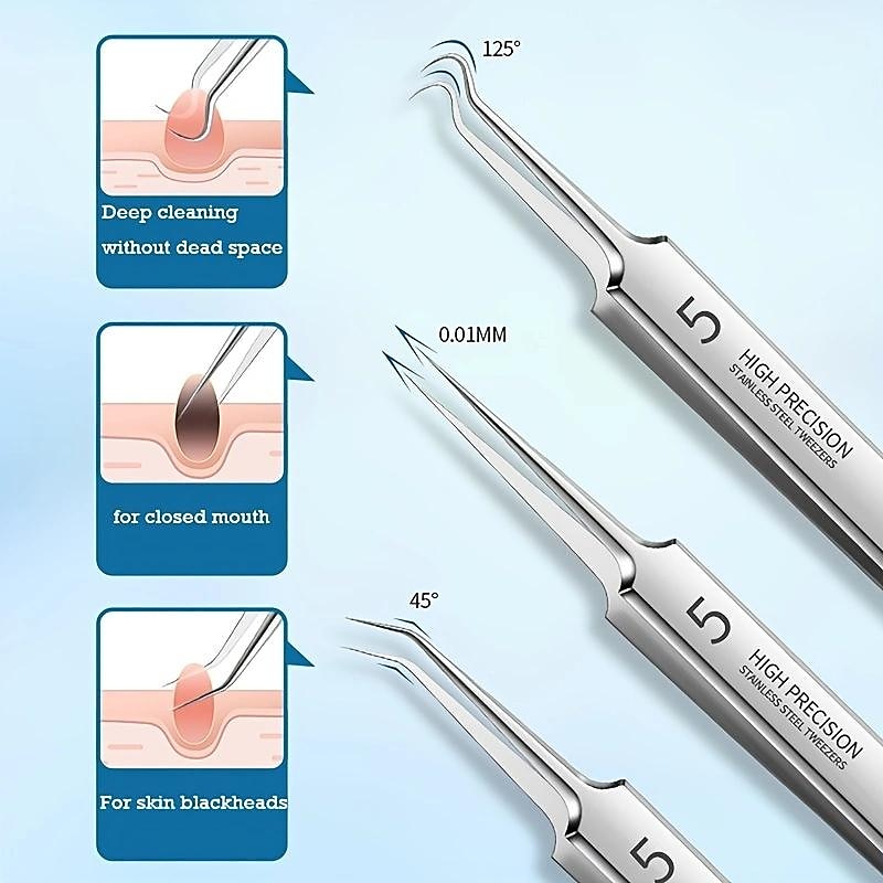 German Ultra-Fine Pimple Tweezers for Acne and Blackhead Removal - Salon Quality Beauty Tool for Face Health and Care