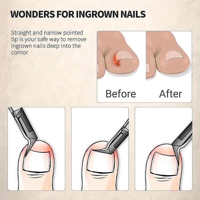 Stainless Steel Toenail Clippers with Sharp Pointed Tip for Ingrown and Thick Nails - Wide Jaw Podiatry Care Tool2