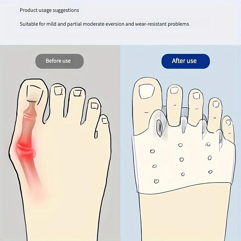 1 Pair Hallux Valgus Corrector, Toe Separators Toe Spacers Split Toe Device, Five Toes Forefoot Pad, Silicone Wearable Shoes for Women2