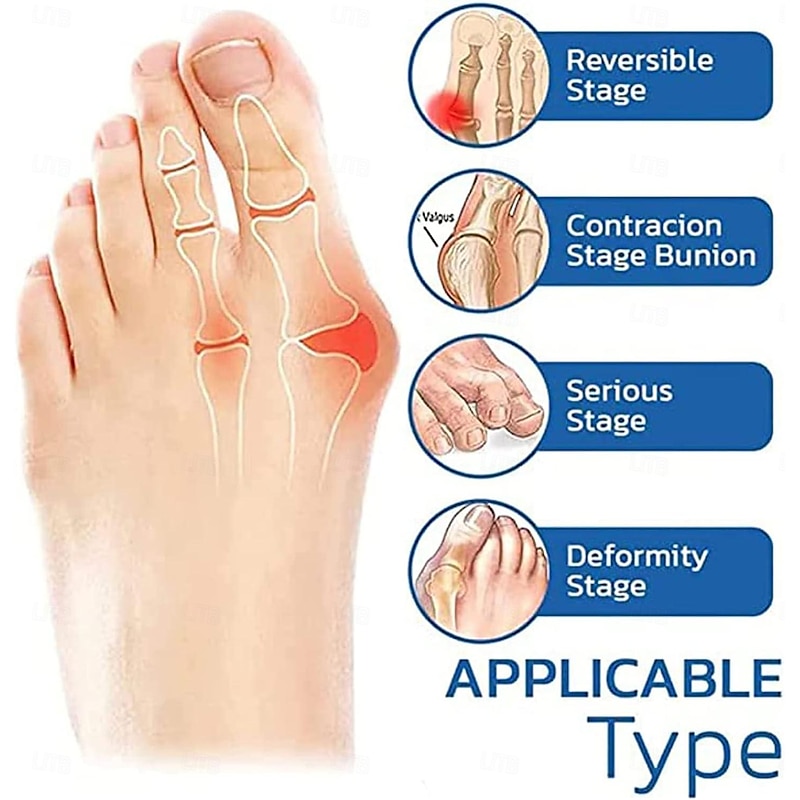 5 Pairs Orthopedic Toe Compression Sock Women's Toe Socks Projoint Antibunions Health Sock - Sock Align Toe Socks for Bunion - Anti Bunion Socks for Women and Men3