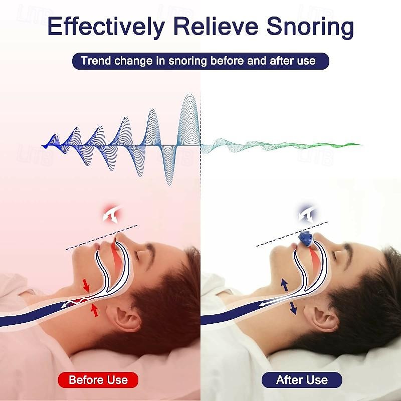 1pc Anti Snoring Devices Nose Air Purifier Snoring Solution Snore Reducing Nose Vents Plugs Anti Snoring Device For Easing Breathing And Comfortable Sleep For Men And Women2