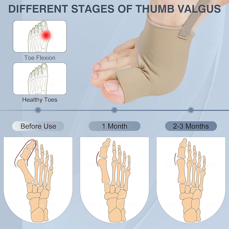 2 Pcs Bunion Corrector for Women Men Bunion Socks Toe Corrector Comfortable Breathable for Day/Night Support, Hallux Valgus Pain Relief Non-Slip Big Toe Straightener L (size 40-45) S (size 35-40)4