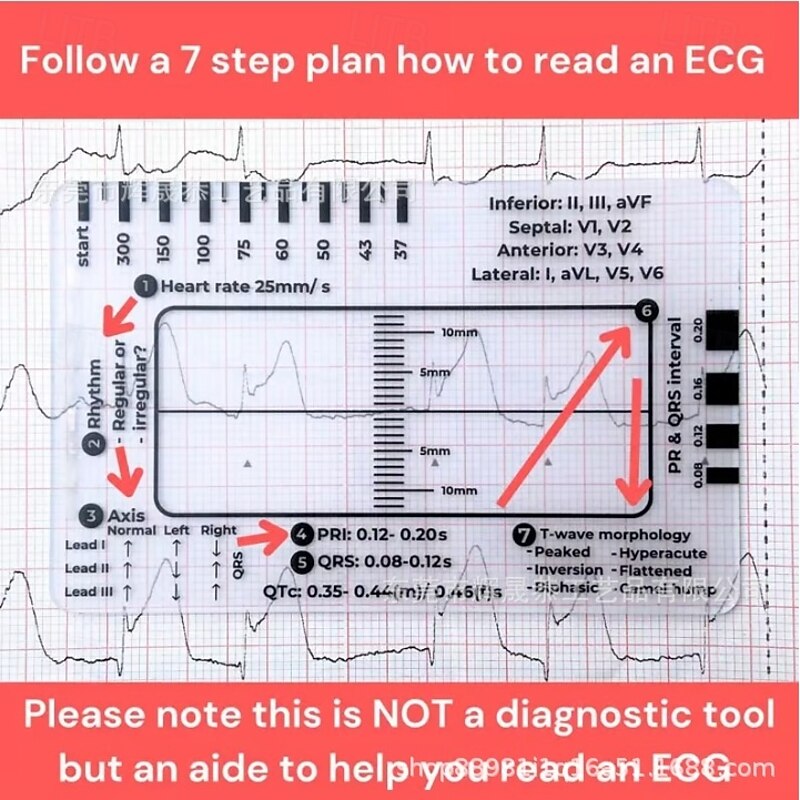 ECG 7 Step Ruler, ECG Ruler Plastic Ruler Measuring Tool, ECG 7 Step Ruler for ECG/EKG Interpretation, Transparent EKG Calipers Measuring Tool, Follow a 7 Step Plan2