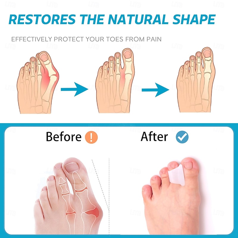 Hammer Toe Straightener Corrector - Toe Spacers Toe Separators for Bunion, Curled Toes, Hammertoes, Toe Corrector Toe Splint for Men and Women 6 Pack4