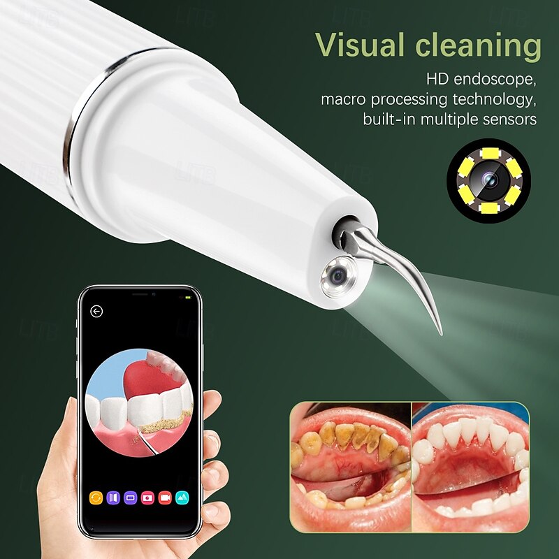 Visual Ultrasonic Dental Scaler Teeth Whitening Cleaner Dental Stone Calculus Plaque Stains Removal Tartar Scraper Oral Hygiene2