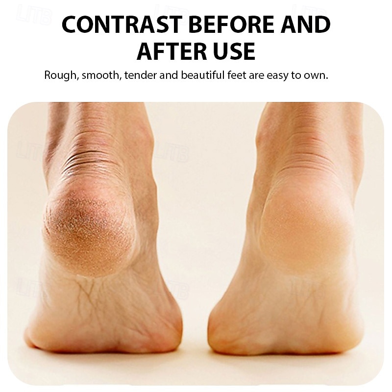 Rechargeable Electric Foot Grinder Dead Skin Remover Calluses Feet Scrubber Electric Foot File Dry Dead Cracked Foot Care Repair3