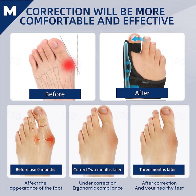 Bunion Corrector for Women Big Toe Straightener Orthopedic Bunion Splint Non Surgical Hallux Valgus Correction Hammer Toe Straightener Comfortable Breathable for Day Night4