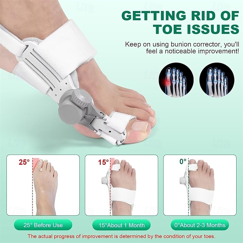 Bunion Corrector for Women Big Toe, 2PCS Bunion Corrector, Adjustable with Non-Slip Big Toe Separator for Right and Left Foot Correction(White)2