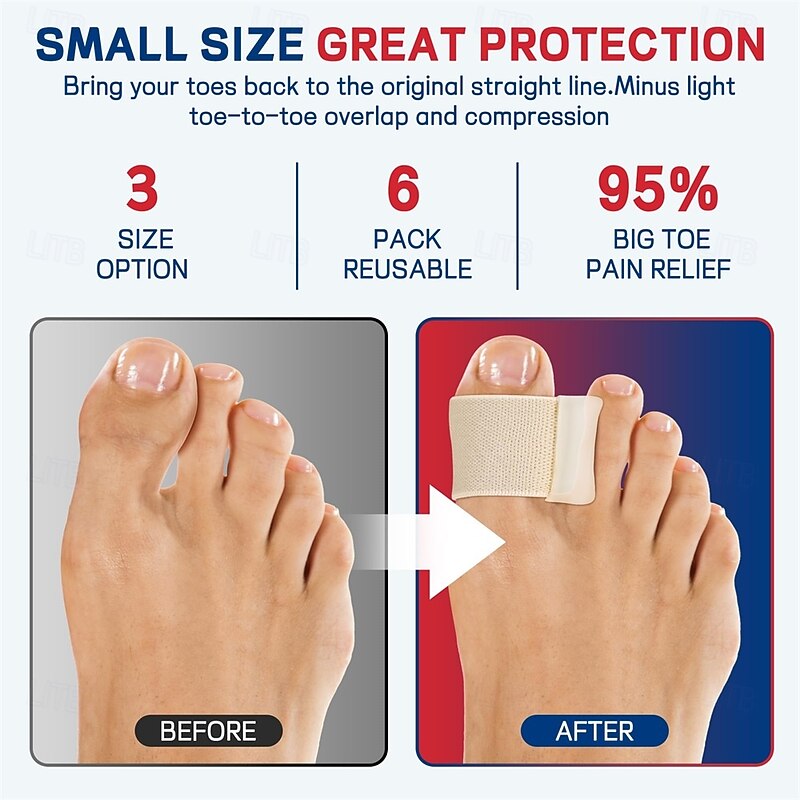 Toe Separator for Overlapping big Toes Big Toe Spacers for Bunion Toe Corrector for Big Toe Alignment and Overlap3