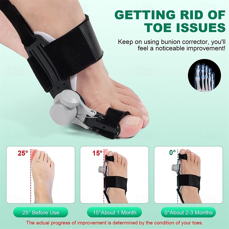 Bunion Corrector for Women Big Toe, 2PCS Bunion Corrector, Adjustable with Non-Slip Big Toe Separator for Right and Left Foot Correction(Black)2