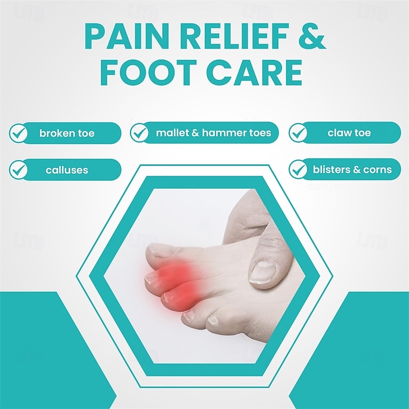 8 Pack Hammer Toe Corrector Toe Splint For Broken Toes Brace Orthopedic Separator Cushioned Bandages Heal Wrap Toe Straighteners for Crooked Toes3