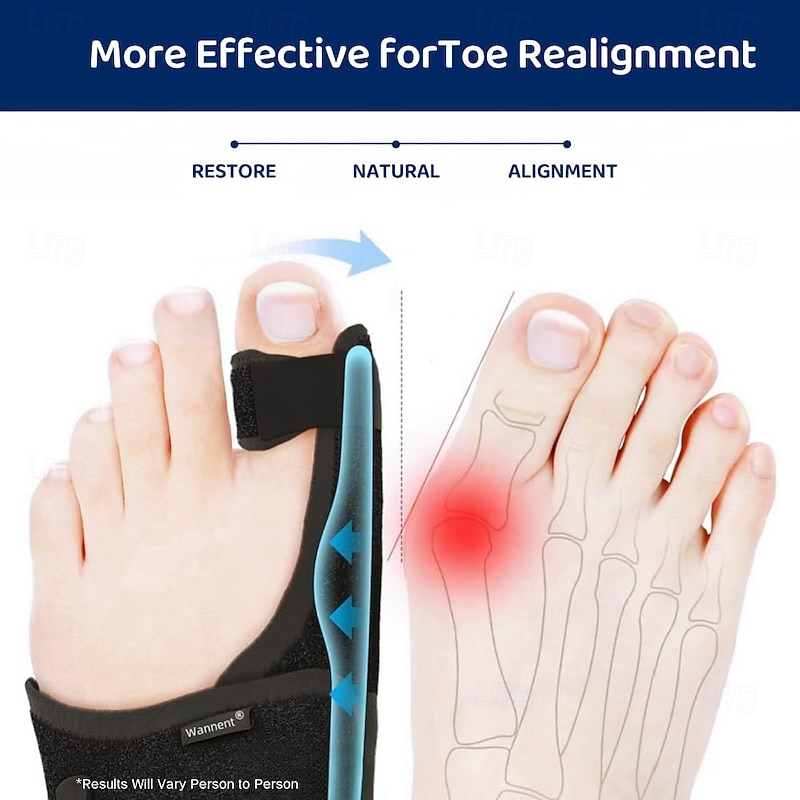 Bunion Corrector for Women Big Toe Straightener Orthopedic Bunion Splint Non Surgical Hallux Valgus Correction Hammer Toe Straightener Comfortable Breathable for Day Night2