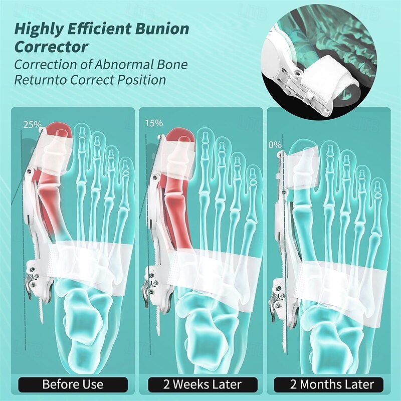 Comfort Bunion Corrector for Women Men Orthopedic Toe Straightener Adjustable Splint Bunion Pads Day Night Support with Toe Separator for Relief2