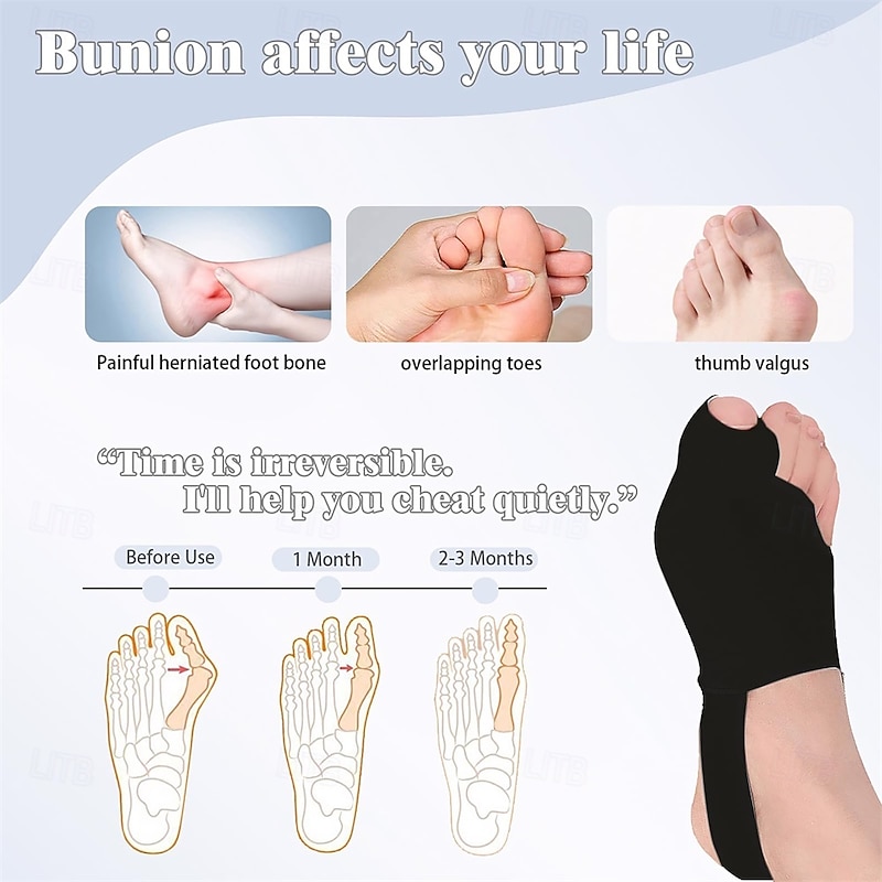 Bunion Corrector for Women Big Toe, Bunion Corrector for Men, Bunion Relief, Bunion Pads, Big Toe Splint, Bunion Fix Preventer Device for Day/Night (2 Count) Black L3