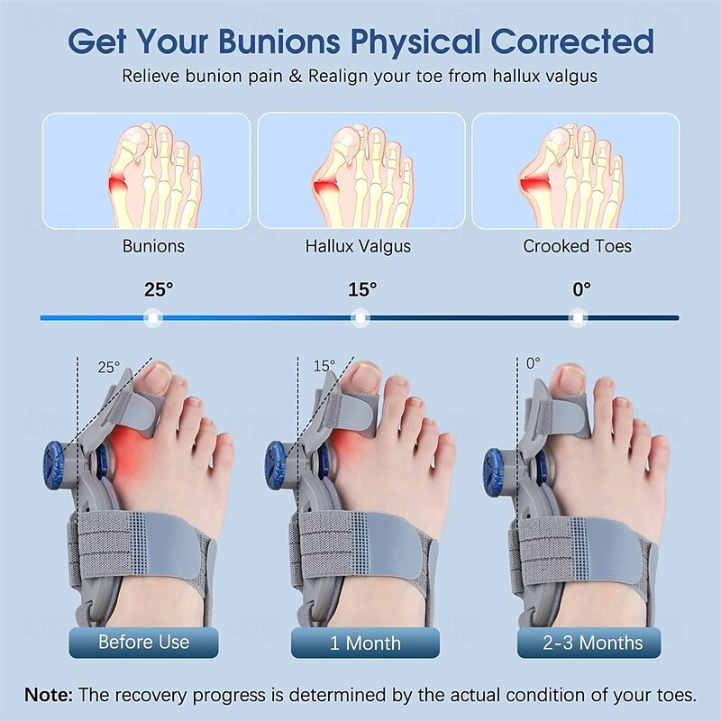 Bunion Corrector for Women Men Big Toe Adjustable Bunion Fix for Big Toe Separation Pain Relief Orthopedic Bunion Splint with Straightener for Toes Alignment Hallux Valgus Correction2