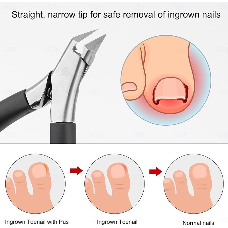 Toenail Clippers for Ingrown Toenails, Stainless Steel Ergonomic Nail Clippers with Sharp Curved Blade, Professional Trimmer for Thick Nails, Dead Skin & Calluses3