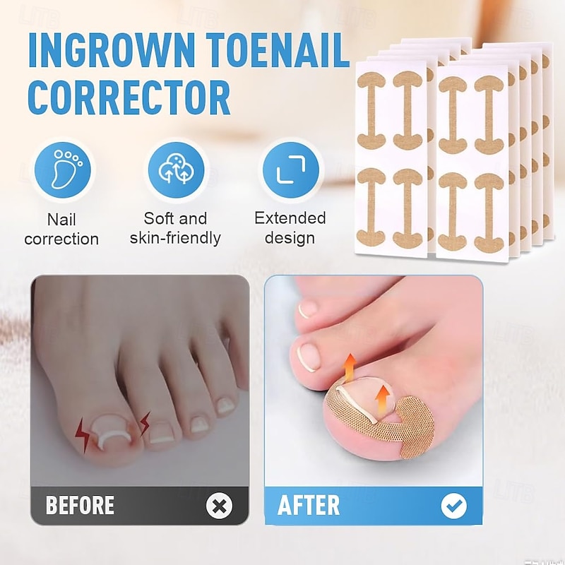 Professional Ingrown Toenail Set with Breathable Ingrown Toenail Strips, Curved Toenails Corrector Patch, Painless File and Lifter Pedicure Tools for Women Man2