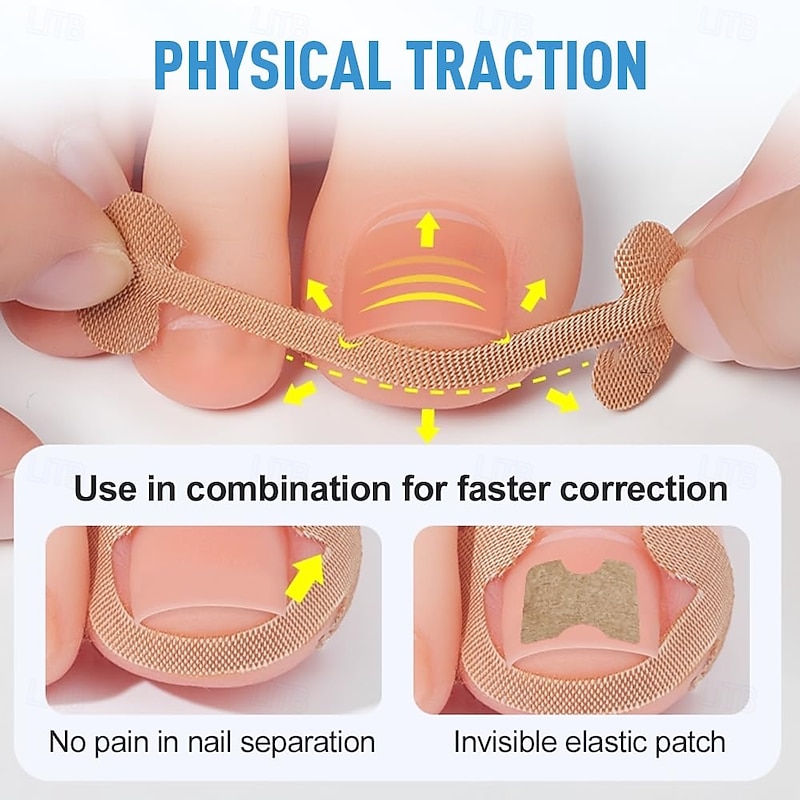 Professional Ingrown Toenail Set with Breathable Ingrown Toenail Strips, Curved Toenails Corrector Patch, Painless File and Lifter Pedicure Tools for Women Man3