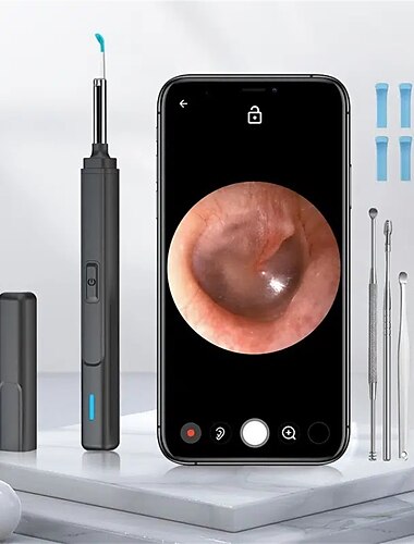  Smart Visual Ohrreiniger Ohrstöpsel Endoskop Ohrstöpsel Kamera Otoskop Ohrreiniger Ohrenschmalz-Entferner Ohrpicker Werkzeug zum Entfernen von Ohrenschmalz
