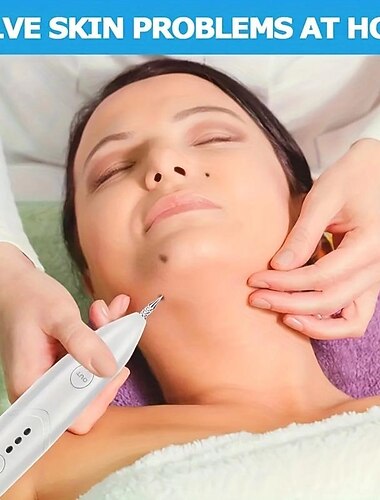  Bolígrafo para eliminar pecas, verrugas, lunares y marcas en la piel: obtenga una piel impecable con esta máquina de cuidado de belleza