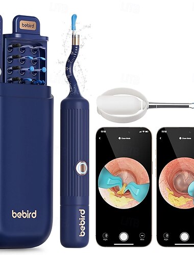  Nástroj na odstraňování ušního mazu earsight plus i35r s kamerou, chytrý vizuální čistič uší s jemnou pinzetou &Tipy pro HD otoskop pro dospělé &děti